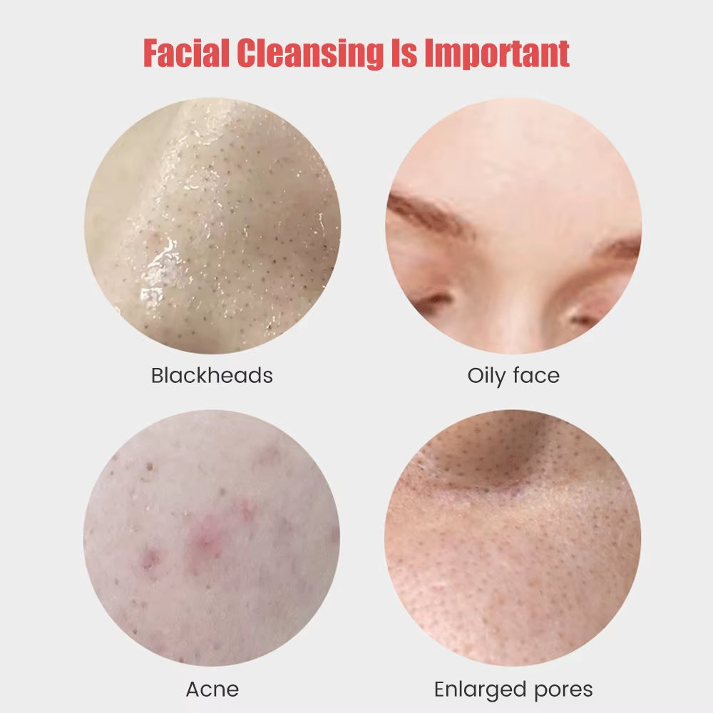 Electric Facial Cleansing Brush - Ultrasonic Vibration Silicone Face Cleanser