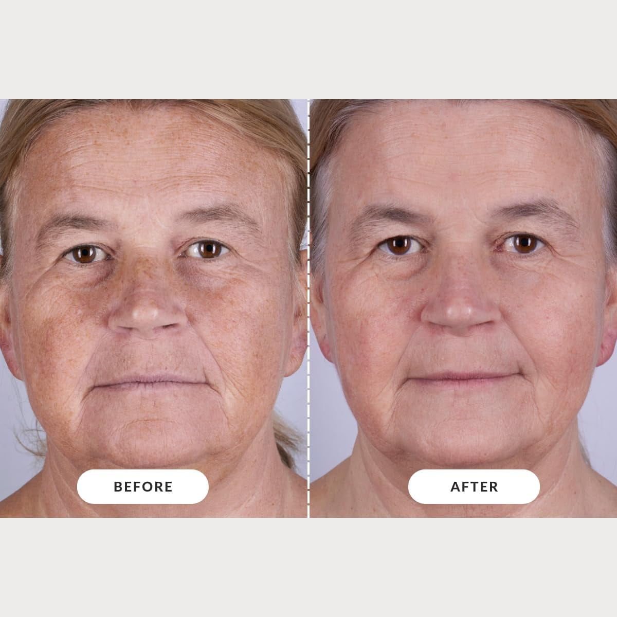 Skin LED Light Therapy Mask: Series 2 | Red Light LED Face Mask for Advanced Anti-Ageing | Red, Near-Infrared and Deep Near-Infrared Wavelengths for Wrinkle Reduction