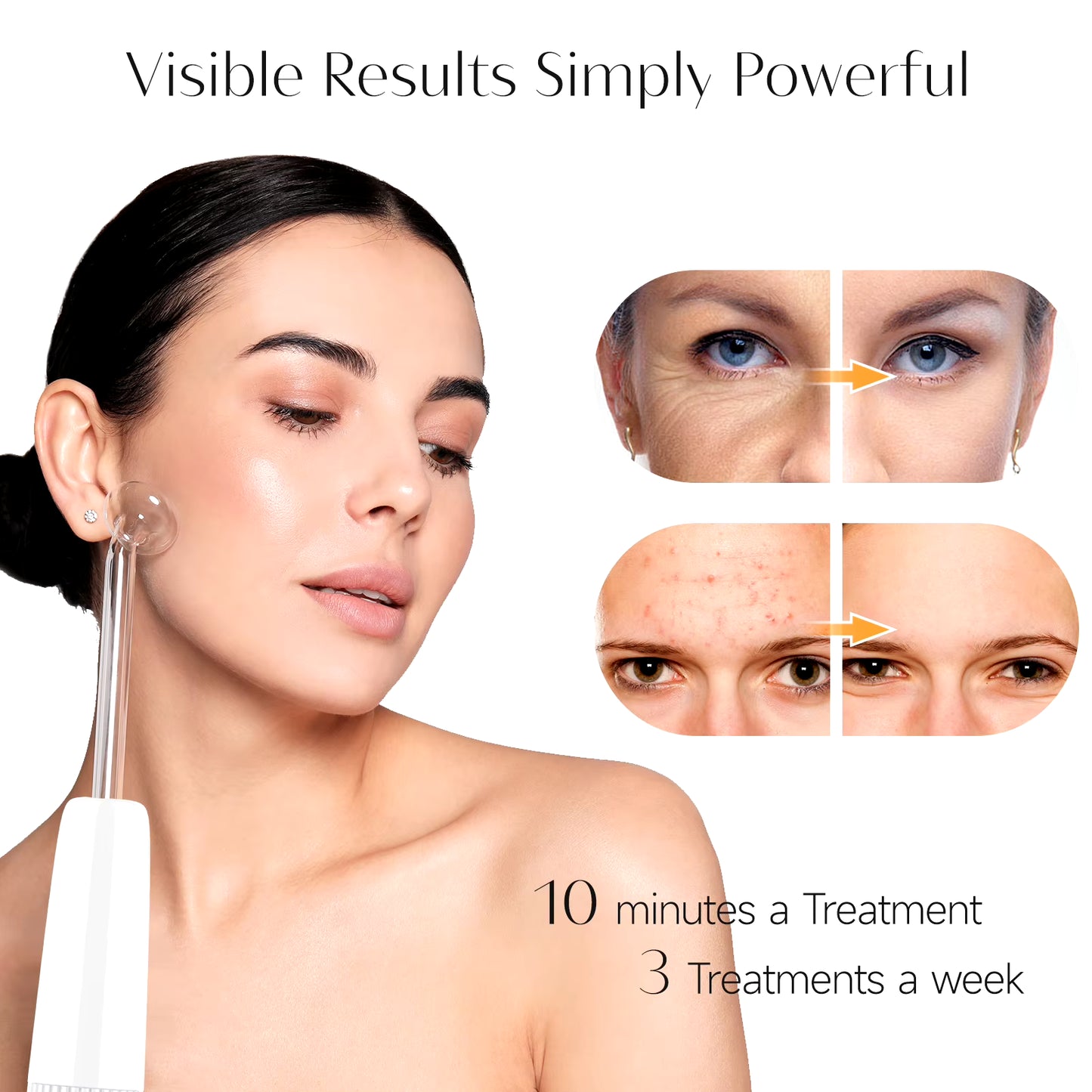 Blue 6-In-1 High Frequency Facial Machine for Hair and Face Fusion Neon+Argon Wands
