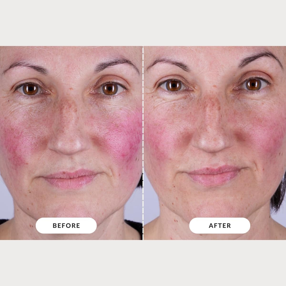 Skin LED Light Therapy Mask: Series 2 | Red Light LED Face Mask for Advanced Anti-Ageing | Red, Near-Infrared and Deep Near-Infrared Wavelengths for Wrinkle Reduction