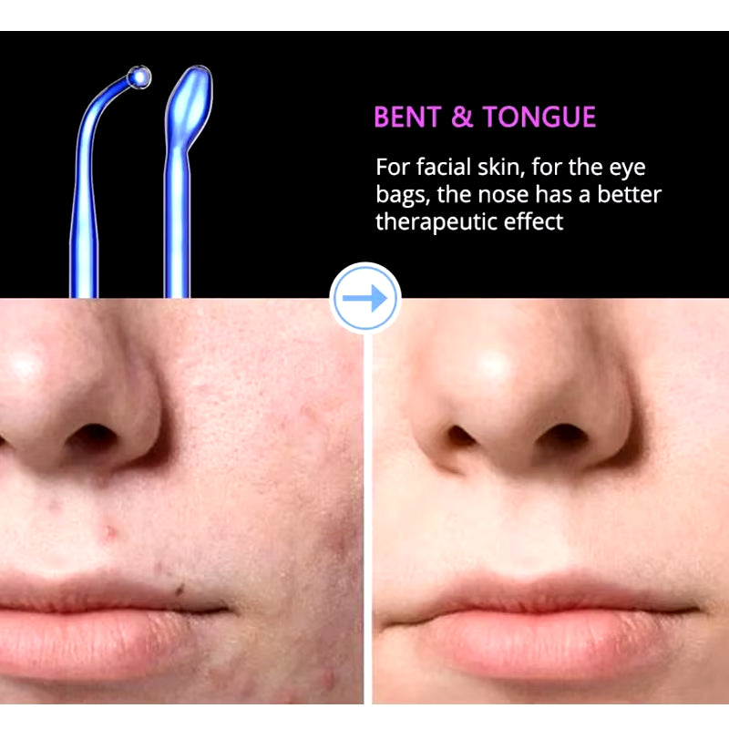 Blue 6-In-1 High Frequency Facial Machine for Hair and Face Fusion Neon+Argon Wands