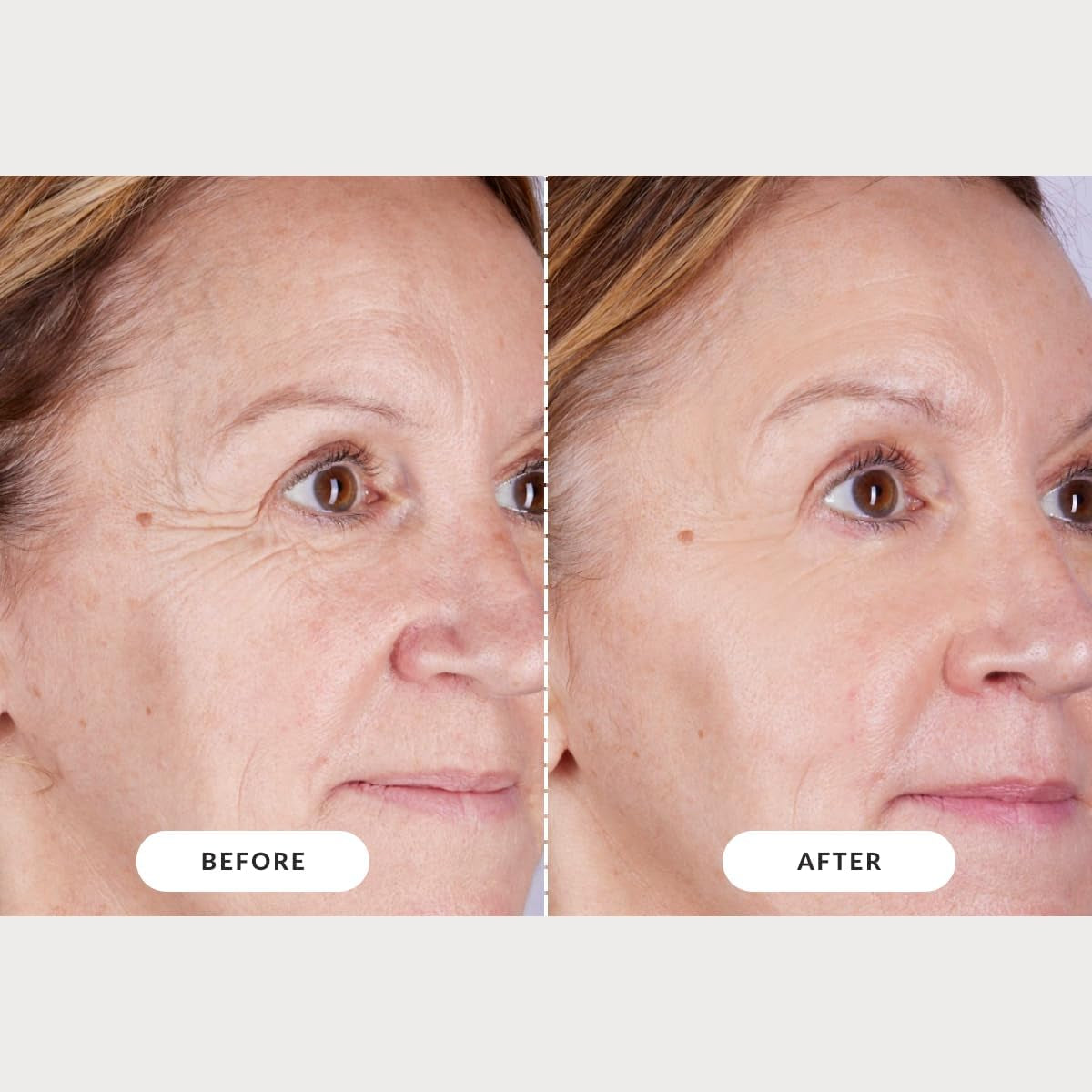 Skin LED Light Therapy Mask: Series 2 | Red Light LED Face Mask for Advanced Anti-Ageing | Red, Near-Infrared and Deep Near-Infrared Wavelengths for Wrinkle Reduction