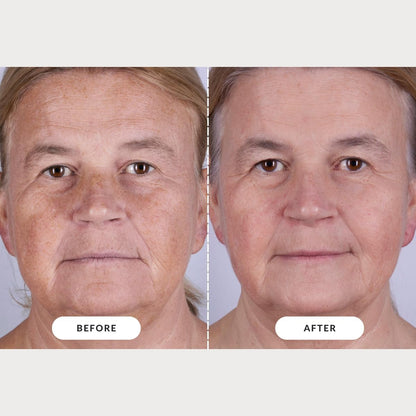 Skin LED Light Therapy Mask: Series 2 | Red Light LED Face Mask for Advanced Anti-Ageing | Red, Near-Infrared and Deep Near-Infrared Wavelengths for Wrinkle Reduction